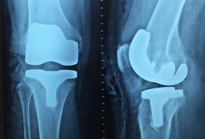 doctor, orthopedics, x-ray, knee, orthopedics, orthopedics, orthopedics, orthopedics, x-ray, x-ray, x-ray, x-ray, x-ray, knee, knee, knee, knee
