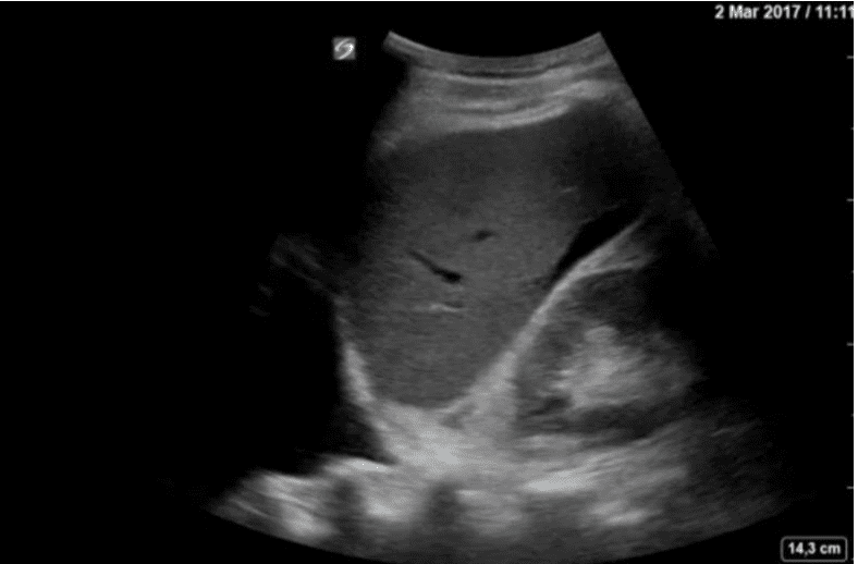 mage d’échographie en noir et blanc.